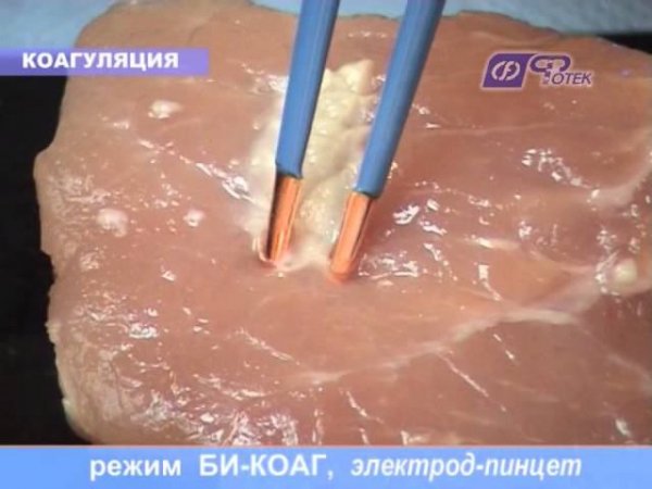 Демонстрация режима: "БиКоаг"