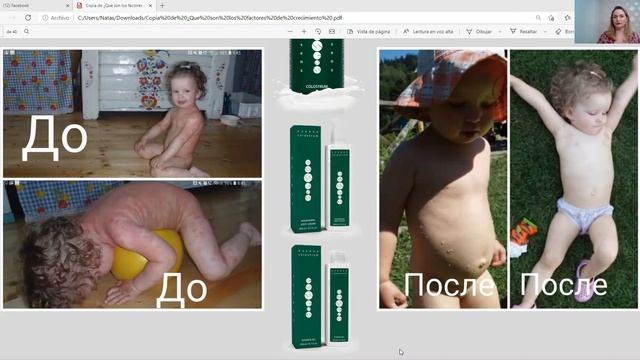 ЧТО ТАКОЕ ФАКТОР РОСТА? ЕГО ПРИМИНЕНИЕ В КОСМЕТИКЕ И ПИЩЕВЫХ ДОБАВКАХ смотреть онлайн