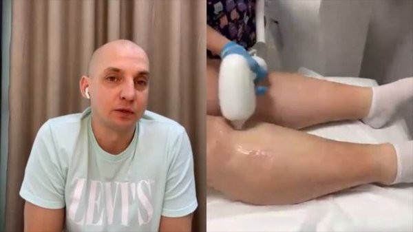 Как проводить лазерную эпиляцию БЕЗОПАСНО и ЭФФЕКТИВНО. Обучение лазерной эпиляции