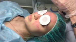 Чистка кожи. Схемы проведения.