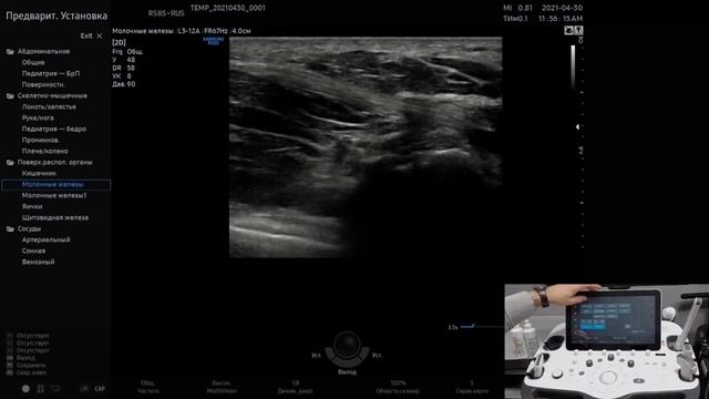 Технология ElastoScan - эластография смотреть онлайн