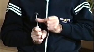 Мозжечковая атаксия © Сerebellar ataxia