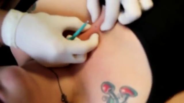microdermal смотреть онлайн