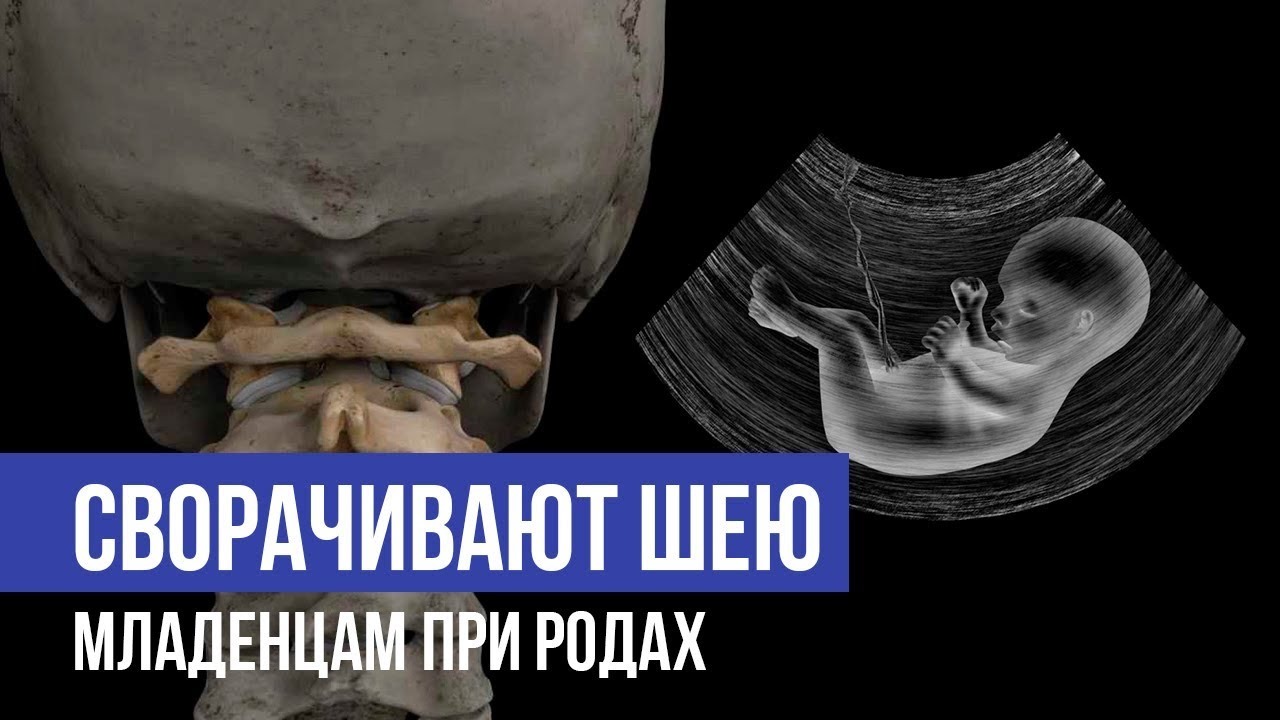 Свобода Атланта или как младенцам сворачивают шеи !!! смотреть онлайн