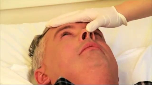 Уход за носом больного с инсультом смотреть онлайн