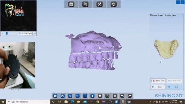 Shining 3d scan hindi -Dental 3d scanner How to Easy scan with normal articulator 3d scanner смотреть онлайн