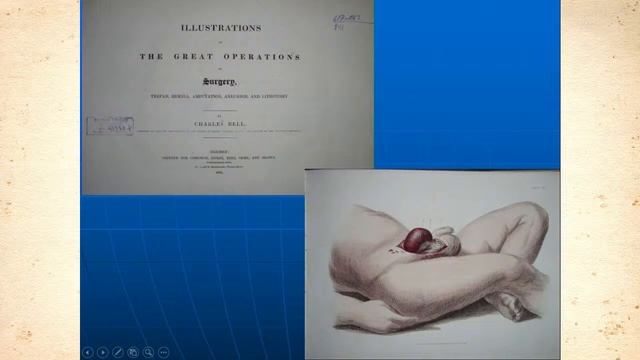 Хирургические эссе в изобразительном искусстве смотреть онлайн