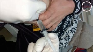 Укол в ягодицу детям в домашних условиях. Внутримышечная инъекция малышу