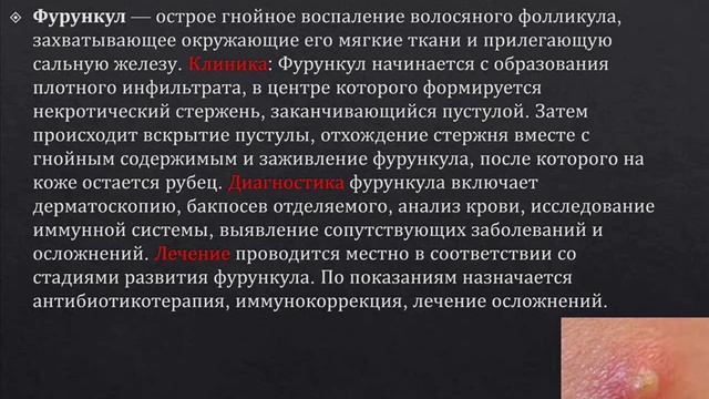 Обучающее видео. Фурункул смотреть онлайн