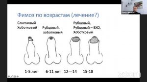 Проблемы крайней плоти у мальчиков: что надо знать родителям