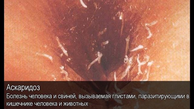 Аскардиоз. Толковый Видеословарь русского языка смотреть онлайн
