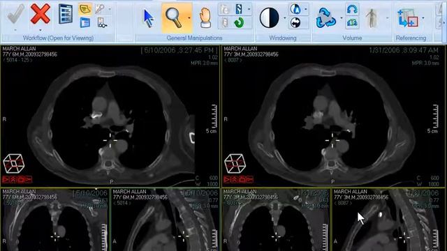 CARESTREAM Vue for Radiology: Power Viewer смотреть онлайн
