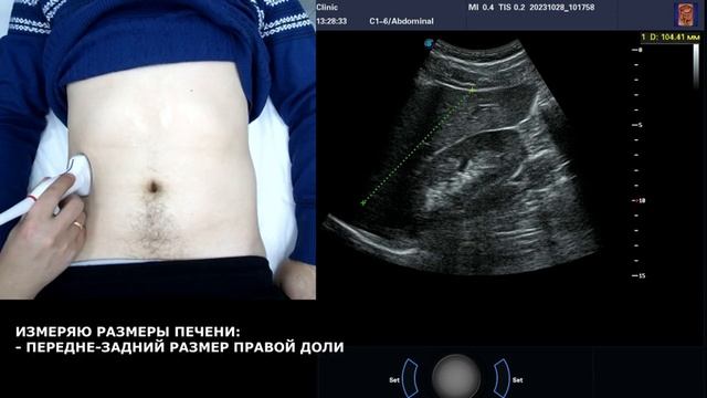 Пишем ПРОТОКОЛ УЗИ органов брюшной полости ВМЕСТЕ смотреть онлайн