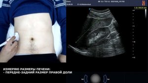 Пишем ПРОТОКОЛ УЗИ органов брюшной полости ВМЕСТЕ