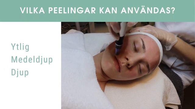 Dermapen behandling med kemisk peeling Stockholm смотреть онлайн