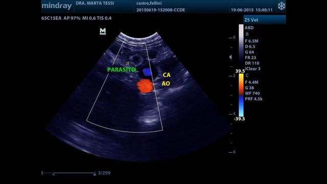 Dioctophyma Renale, Intra Y Extra Renal