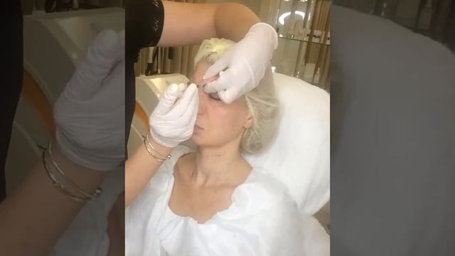 Ботокс лица смотреть онлайн