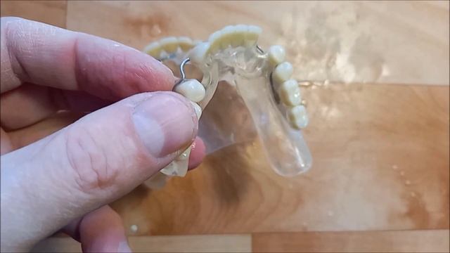 Гипоаллергенные съёмные зубные протезы. Бесцветная пластмасса.  Фторакс.