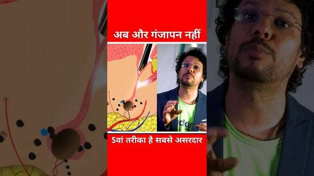 Hair Loss | Hair Fall | Hair Damage | Hair Regrowth | PRP | Minoxidil | Hair Transplant | Fue | Ado