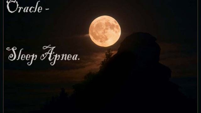 Alber project (Sap) - Oracle смотреть онлайн