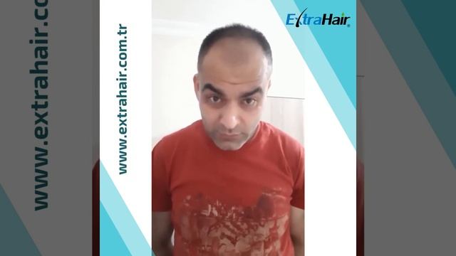 Extra Hair Yeşil Serumu