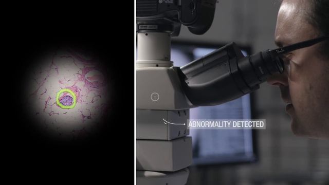 Detecting cancer in real-time with machine learning смотреть онлайн