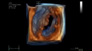 УЛЬТРАЗВУКОВАЯ СИСТЕМА GE VIVID E90