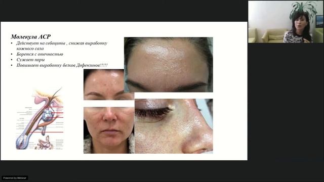 Биоревитализация: Соло. Дуэт. Ансамбль смотреть онлайн