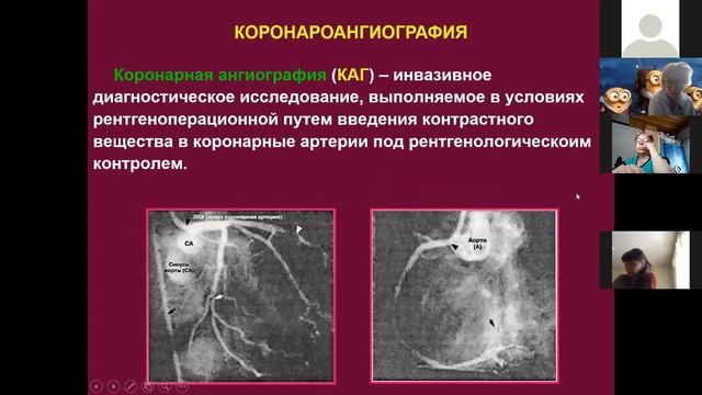 Сестринская помощь при атеросклерозе. Неврычева Е.В. смотреть онлайн