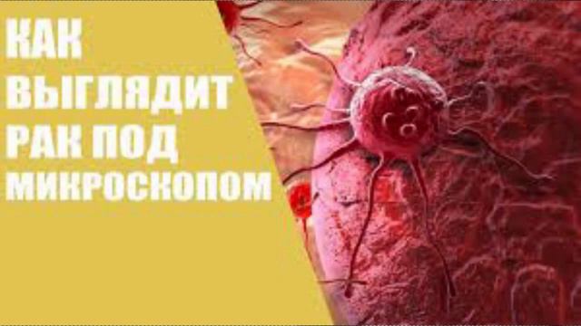 Тополиное печенье для онкобольных разработали ученые SUB ENG смотреть онлайн