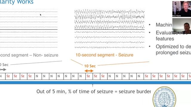 EPM Talk Ep. 61 - Point of Care EEG with Dr. Matt Kaplan смотреть онлайн