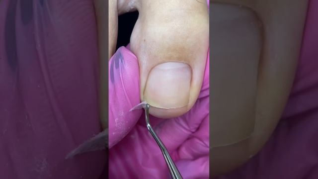 Для чего нужен Каполин? #педикюр #сочи #маникюр #гельлак смотреть онлайн