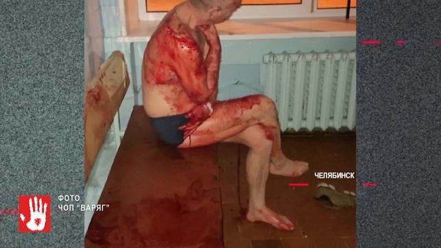 В больницу в центре Челябинска заявился буйный окровавленный мужчина смотреть онлайн
