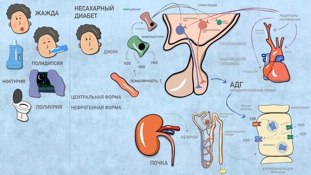 Несахарный диабет (Diabetes insipidus). смотреть онлайн