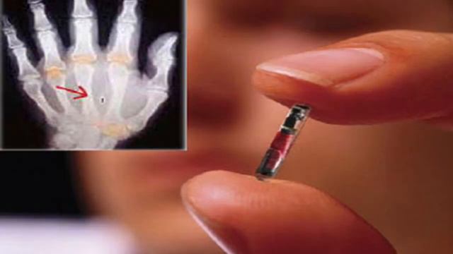 Илон Маск : Через пол года мы начнём вживлять ЧИПы в людей ||(видео) смотреть онлайн