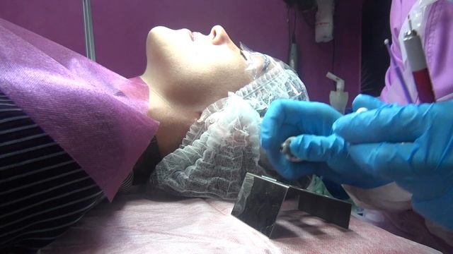 Анестезия брови перед микроблейдингом Начало процедуры смотреть онлайн