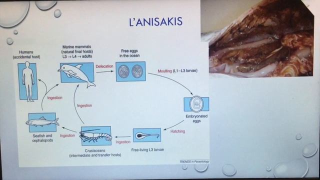 Anisakis, vidéo 3/4 sur les Parasitoses Alimentaires смотреть онлайн