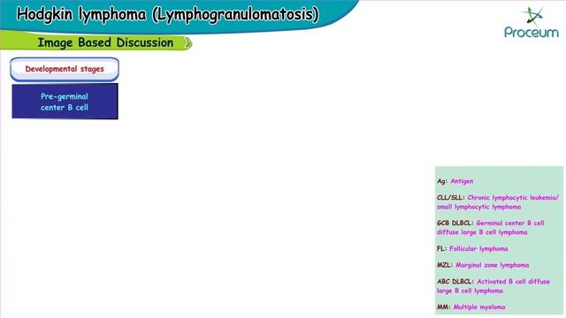 Hodgkin's lymphoma (Lymphogranulomatosis) : #Usmle Imaged based discussion смотреть онлайн