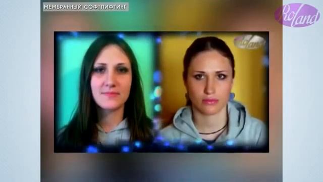 'Мембранный софтлифтинг' Актуальное интервью часть 1 2014 смотреть онлайн