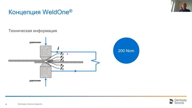 ВЕБИНАР_Протезирование с использованием внутриротовой сварки WeldOne