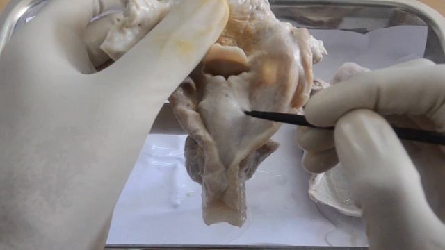 PYRIFORM FOSSA & LARYNGEAL CAVITY смотреть онлайн