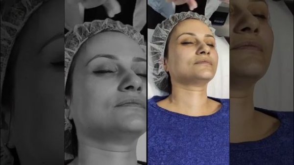 Пилинг Perfection Forte от IMAGE Skincare