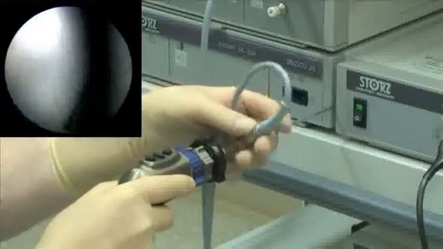 Принцип работы c артроскопом. смотреть онлайн