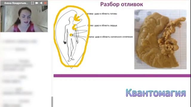 Почему важно чистить свою ауру смотреть онлайн