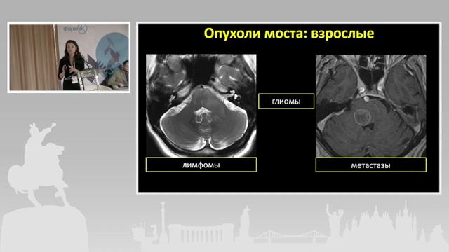 Ирина Трофименко. Топический подход в нейрорадиологии: Мост смотреть онлайн