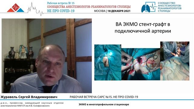 ЭКМО в многопрофильном стационаре Журавель С.В. смотреть онлайн