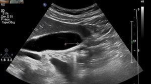 УЗИ анатомия органов брюшной полости.