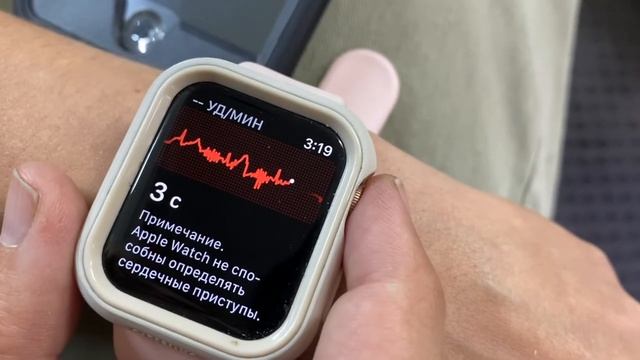 Сша ?? Как сделать электрокардиограмму с вашим Apple Watch 6 поколения смотреть онлайн