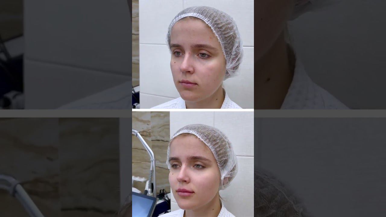 Бьютификация молодых лиц смотреть онлайн