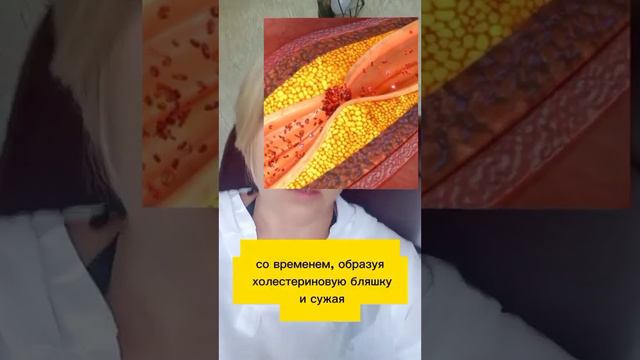 откуда берутся тромбы смотреть онлайн